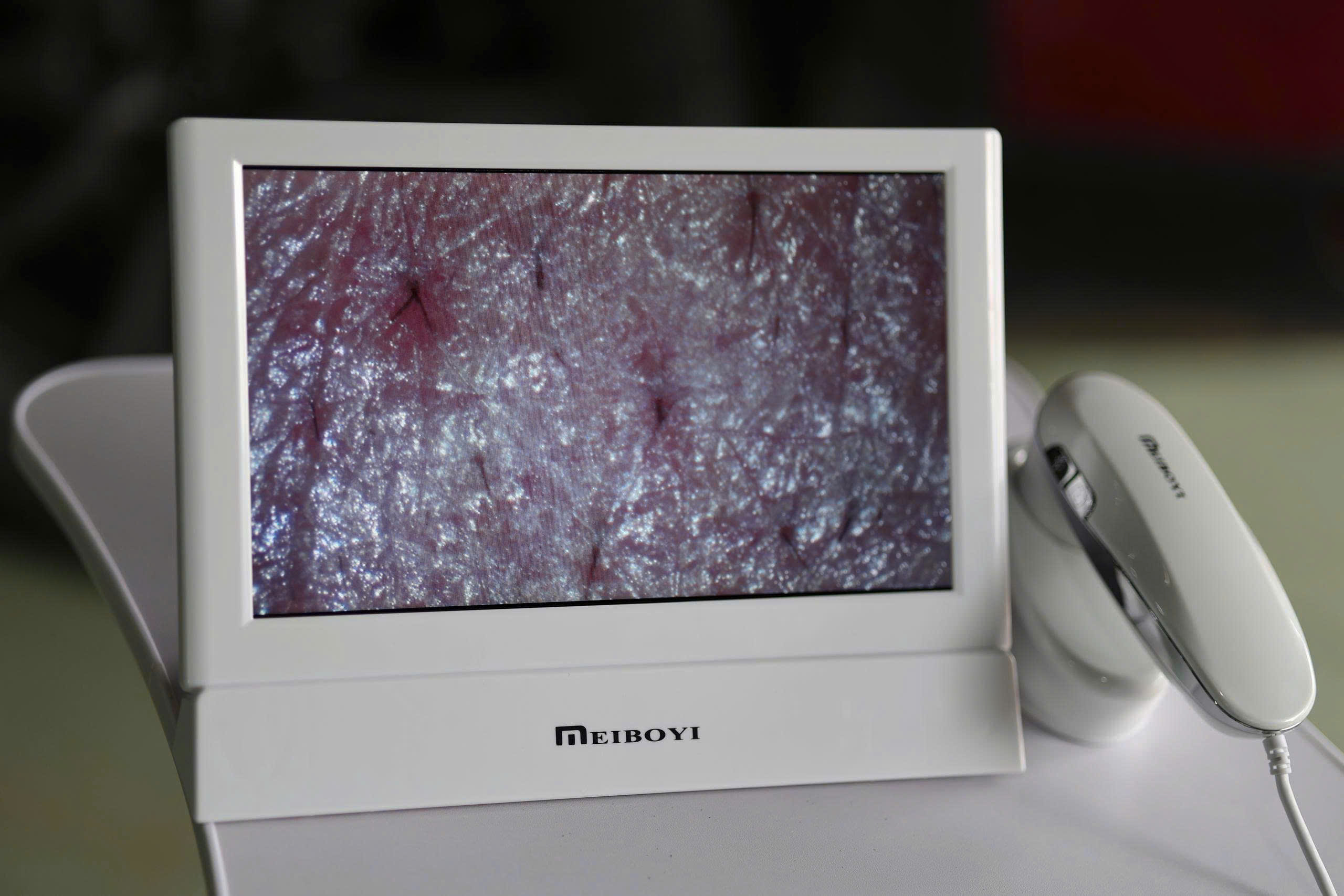 MÁY SOI DA MEYBOIMÁY SOI DA MEYBOI